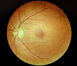 Retina